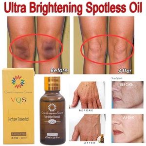 30 Ml Ultra Brightening Spotless Oil Skin Care